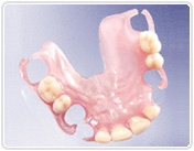 Aesthetic Denture